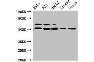 Western Blot Positive WB detected in: Hela whole cell lysate, PC-3 whole cell lysate, HepG2 whole cell lysate, Mouse kidney tissue, Mouse brain tissue All lanes: NR5A2 antibody at 3 μg/mL Secondary Goat polyclonal to rabbit IgG at 1/50000 dilution Predicted band size: 62, 57, 43, 54 kDa Observed band size: 62, 54 kDa