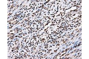 Immunohistochemical staining of paraffin-embedded Kidney tissue using anti-APP mouse monoclonal antibody. (APP anticorps)