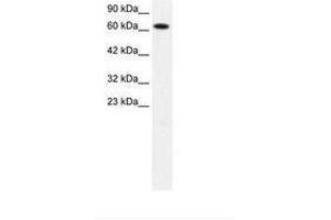 Image no. 2 for anti-Protein Inhibitor of Activated STAT, 3 (PIAS3) (AA 548-597) antibody (ABIN202823)