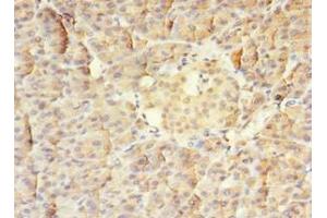 Immunohistochemistry of paraffin-embedded human pancreatic tissue using ABIN7159585 at dilution of 1:100 (MTR anticorps  (AA 923-1265))