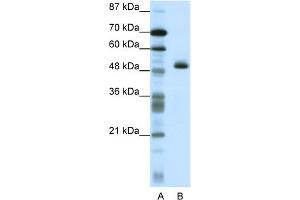 WB Suggested Anti-ZNF213 Antibody Titration:  1. (ZNF213 anticorps  (N-Term))