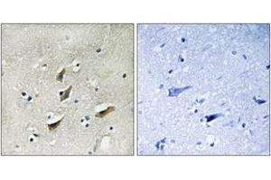 Immunohistochemistry analysis of paraffin-embedded human brain tissue, using Dematin (Ab-403) Antibody.