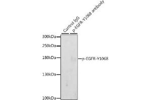 Immunoprecipitation analysis of 200 μg extracts of A-431 cells, using 3 μg Phospho-EGFR-Y1068 pAb (ABIN3020069, ABIN3020070, ABIN3020071 and ABIN6225505).