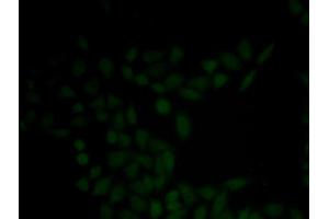 Immunofluorescence analysis of HeLa cell using KRT5 antibody