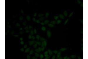 Immunofluorescence analysis of HeLa cell using KRT5 antibody (Cytokeratin 5 anticorps)