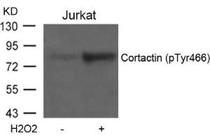 Western blot analysis of extracts from Jurkat cells untreated or treated with H2O2 using Cortactin(Phospho-Tyr466) Antibody. (Cortactin anticorps  (pTyr466))