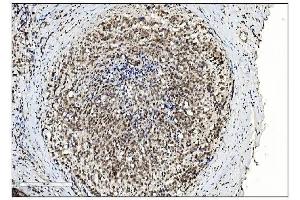 IHC analysis of SUMO2/3 using anti-SUMO2/3 antibody (ABIN7600856). (SUMO2/3 anticorps  (AA 24-72))