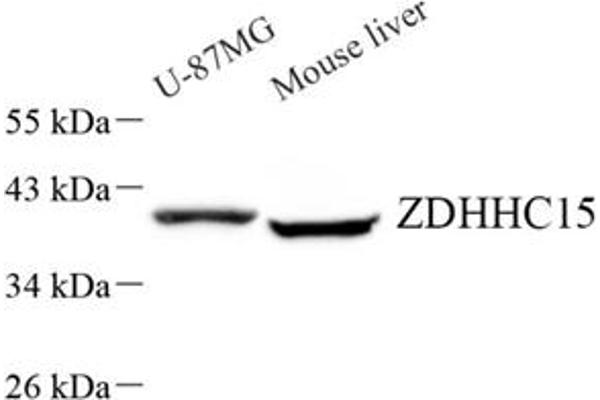 ZDHHC15 antibody