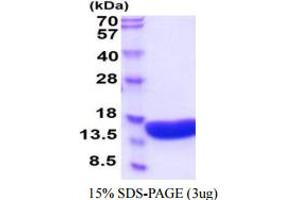 SDS-PAGE (SDS) image for Vesicle-Associated Membrane Protein 2 (Synaptobrevin 2) (VAMP2) (AA 1-94) protein (His tag) (ABIN7281268)