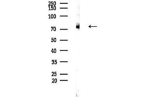 anti-Guanylate Cyclase 1 Soluble Subunit Alpha (GUCY1A1) (C-Term) antibody