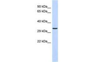 Image no. 1 for anti-Ventral Anterior Homeobox 1 (VAX1) (N-Term) antibody (ABIN6740506) (VAX1 anticorps  (N-Term))