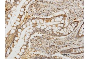 Immunoperoxidase of monoclonal antibody to NMI on formalin-fixed paraffin-embedded human small Intestine. (NMI anticorps  (AA 1-100))