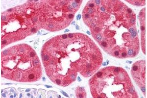 Human Kidney: Formalin-Fixed, Paraffin-Embedded (FFPE)