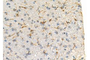 ABIN6266253 and ABIN6277443 at 1/100 staining Rat brain tissue by IHC-P.
