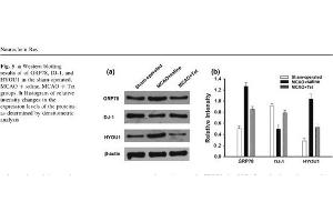 Rat brain lysates probed with Rabbit Anti-ORP150 Polyclonal Antibody (HYOU1 anticorps  (AA 401-500))