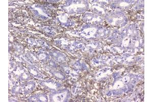 IHC analysis of Beta 2 Microglobulin using anti-Beta 2 Microglobulin antibody (ABIN6719452). (beta-2 Microglobulin anticorps  (AA 22-119))