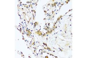 Immunohistochemistry of paraffin-embedded human lung using B antibody (ABIN7265851) at dilution of 1:100 (40x lens). (BAG3 anticorps  (AA 380-575))