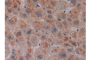 DAB staining on IHC-P; Samples: Human Liver Tissue