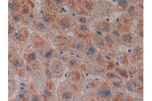 DAB staining on IHC-P; Samples: Human Liver Tissue (CENPE anticorps  (AA 2450-2590))