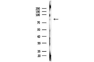 anti-Nucleolar Protein 11 (NOL11) antibody