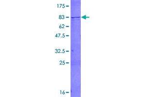 Image no. 1 for SWI/SNF Related, Matrix Associated, Actin Dependent Regulator of Chromatin, Subfamily D, Member 1 (SMARCD1) (AA 1-476) protein (GST tag) (ABIN1320639)