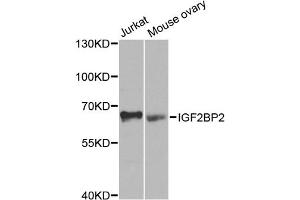 Western blot analysis of extracts of various cell lines, using IGF2BP2 antibody (ABIN5971464) at 1/1000 dilution. (IGF2BP2 anticorps)