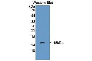 Western Blotting (WB) image for anti-Complement Factor B (CFB) (AA 476-592) antibody (ABIN3205630) (Complement Factor B anticorps  (AA 476-592))