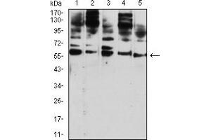 Western blot analysis using CD209 mouse mAb against Hela (1), U937 (2), THP-1 (3), HL-60 (4), and A431 (5) cell lysate.