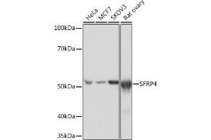 Western blot analysis of extracts of various cell lines, using SFRP4 Rabbit mAb (ABIN7270180) at 1:1000 dilution. (SFRP4 anticorps)