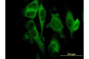 Immunofluorescence of monoclonal antibody to GSDMDC1 on HeLa cell. (GSDMD anticorps  (AA 1-484))