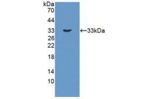 Figure. (HSD17B3 anticorps  (AA 1-310))
