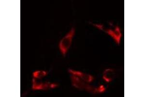 ABIN6275027 staining HuvEc cells by IF/ICC. (CEP95 anticorps  (Internal Region))