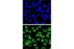 Confocal immunofluorescent analysis of MDM2 antibody with HeLa cells followed by Alexa Fluor 488-conjugated goat anti-rabbit lgG (green). (MDM2 anticorps  (AA 141-176))
