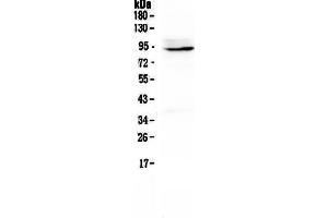 Western blot analysis of PTPN22 using anti-PTPN22 antibody .