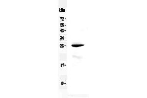 Western blot analysis of RND1 using anti-RND1 antibody . (RND1 anticorps  (AA 105-229))