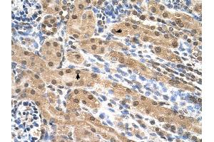 EIF3M antibody was used for immunohistochemistry at a concentration of 4-8 ug/ml to stain Epithelial cells of renal tubule (arrows) in Human Kidney. (Eukaryotic Translation Initiation Factor 3, Subunit M (EIF3M) (N-Term) anticorps)
