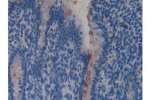 DAB staining on IHC-P; Samples: Rat Intestine Tissue