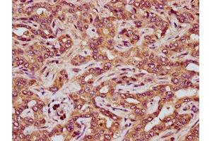 IHC image of ABIN7167744 diluted at 1:200 and staining in paraffin-embedded human liver tissue performed on a Leica BondTM system.