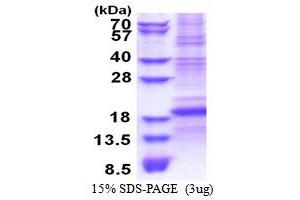 SDS-PAGE (SDS) image for CD8b Molecule (CD8B) (AA 22-170) protein (His tag) (ABIN5853494) (CD8B Protein (AA 22-170) (His tag))