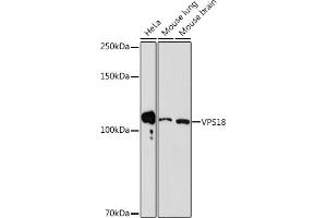 Western blot analysis of extracts of various cell lines, using VPS18 Rabbit mAb (ABIN7271274) at 1:1000 dilution.