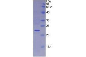 SDS-PAGE analysis of Mouse TIMP4 Protein. (TIMP4 Protéine)