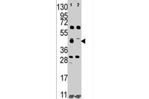 Western blot analysis of FDFT1 polyclonal antibody  in A-375 cell line lysate . (FDFT1 anticorps  (Internal Region))