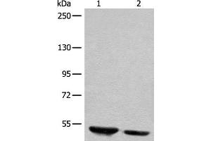 Western blot analysis of Human fetal brain tissue and mouse brain tissue lysates using DENND1B Polyclonal Antibody at dilution of 1:400