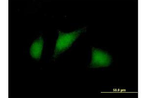 Immunofluorescence of purified MaxPab antibody to TSC22D1 on HeLa cell. (TSC22D1 anticorps  (AA 1-144))