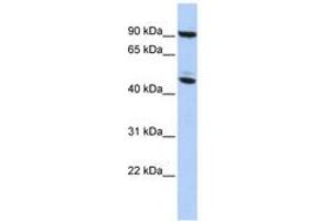 Image no. 1 for anti-Methyl CpG Binding Protein 2 (MECP2) (AA 35-84) antibody (ABIN6742304) (MECP2 anticorps  (AA 35-84))