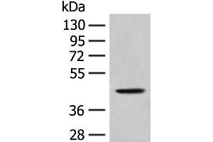 Western blot analysis of A549 cell lysate using HLA-B Polyclonal Antibody at dilution of 1:400 (HLA-B anticorps)