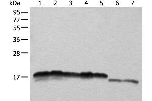 Western blot analysis of Hela HEPG2 A431 K562 and 231 cell Mouse liver tissue and Mouse brain tissue lysates using NDUFB11 Polyclonal Antibody at dilution of 1:1000