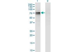 Western Blot analysis of CBFA2T2 expression in transfected 293T cell line by CBFA2T2 monoclonal antibody (M05), clone 3A2. (CBFA2T2 anticorps  (AA 201-304))