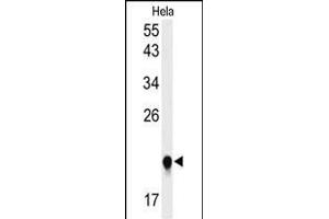 Western blot analysis of I Antibody (C-term)&65288,Cat(ABIN653856 and ABIN2843116)) in Hela cell line lysates (35 μg/lane). (IMP3 anticorps  (C-Term))
