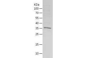 Western Blotting (WB) image for Melanoma Antigen Family F, 1 (MAGEF1) (AA 1-307) protein (His tag) (ABIN7123903) (MAGEF1 Protein (AA 1-307) (His tag))